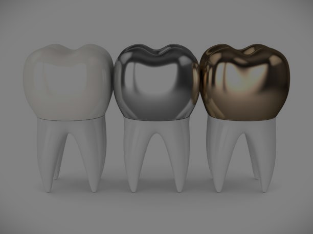 Learn more about crowns and bridges at Dental Professionals of Spring