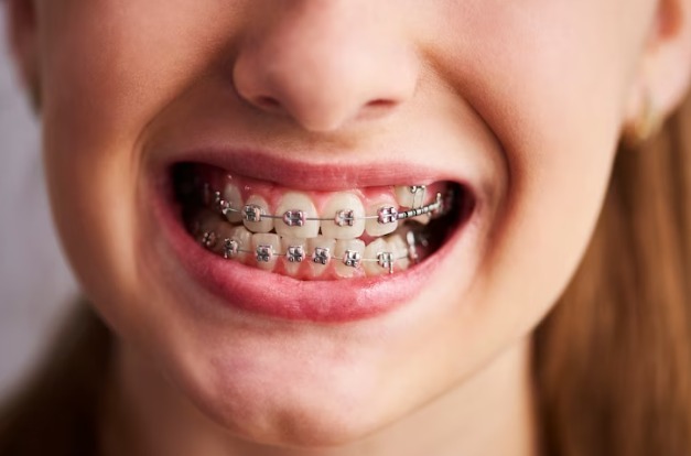 Dentures in Spring