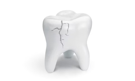 Dental Care in Spring